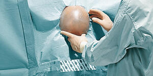 Foliodrape Protect Plus Neurochirurgie-Set II
